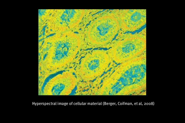A slide of yellow and teal cellular material magnified, with text beneath it reading " Hyper spectral image of cellular material (Berger, Coifman, et al, 2008)"