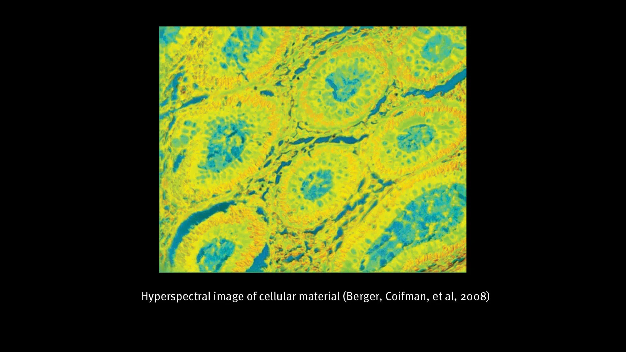 A slide of yellow and teal cellular material magnified, with text beneath it reading " Hyper spectral image of cellular material (Berger, Coifman, et al, 2008)"